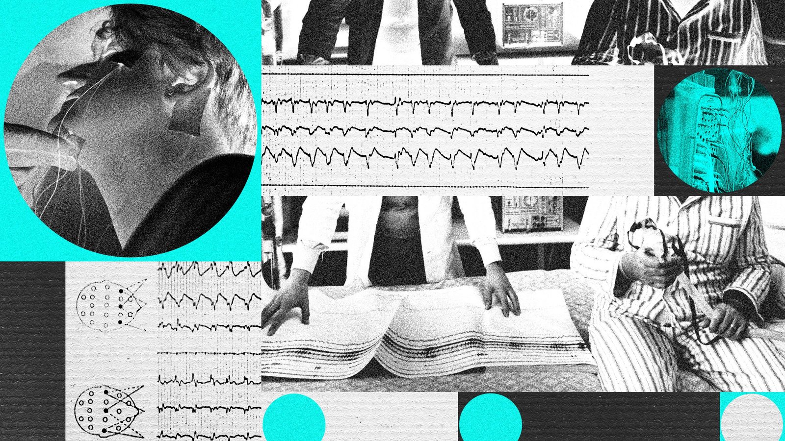 Beyond CPAP: New Tech Revolutionizes Sleep Apnea Care